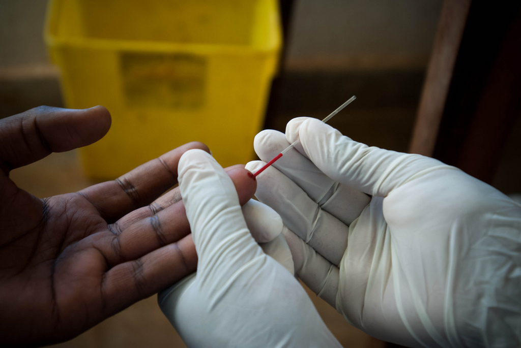 Condițiile de viață fără tratamentul HIV | Zanzu